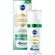 NIVEA Luminous630 Antidark-spot Post-Acne Marks Serum 30 ml